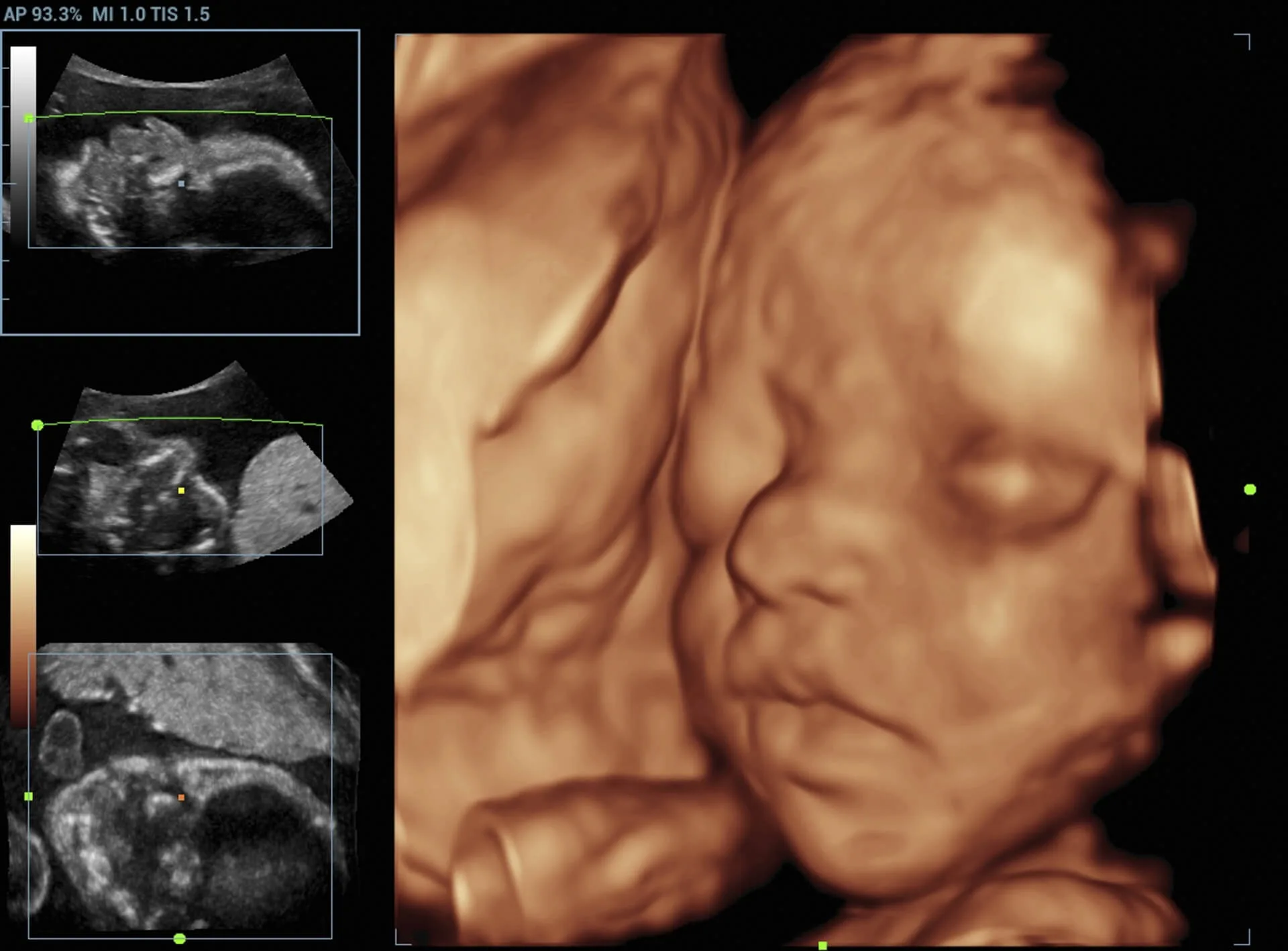 Ultrasound Services: 2D, 3D & 4D Imaging Explained