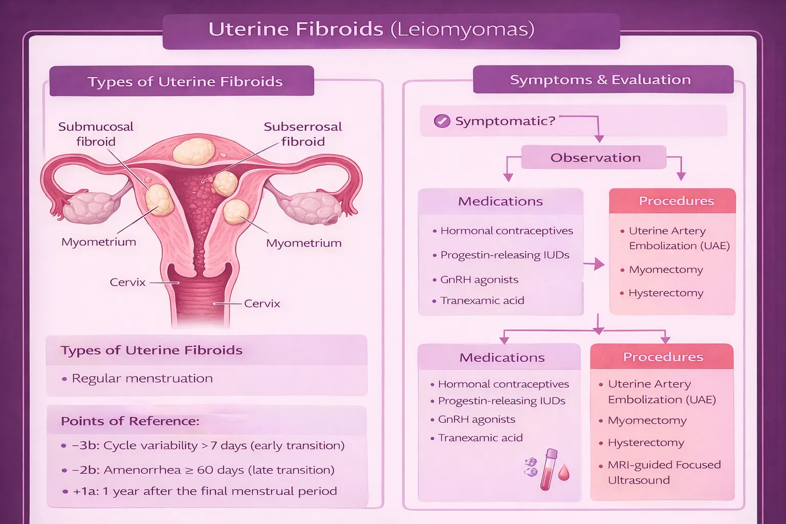Anatomical diagram showing fibroid types by location - submucosal, intramural, subserosal, and pedunculated fibroids in cross-section of the uterus